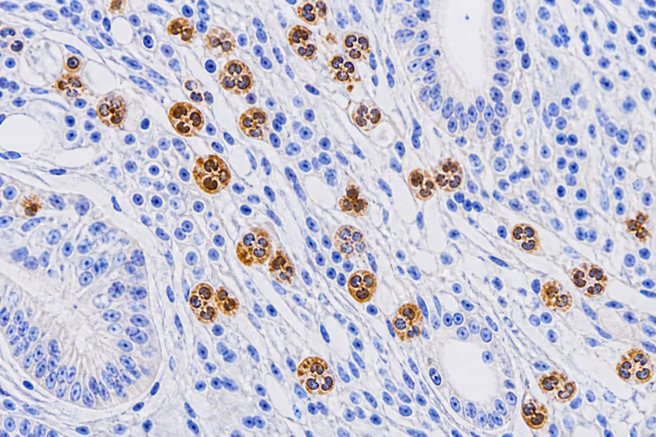 Neutrophil Staining Immunohistochemistry in a Tissue Section