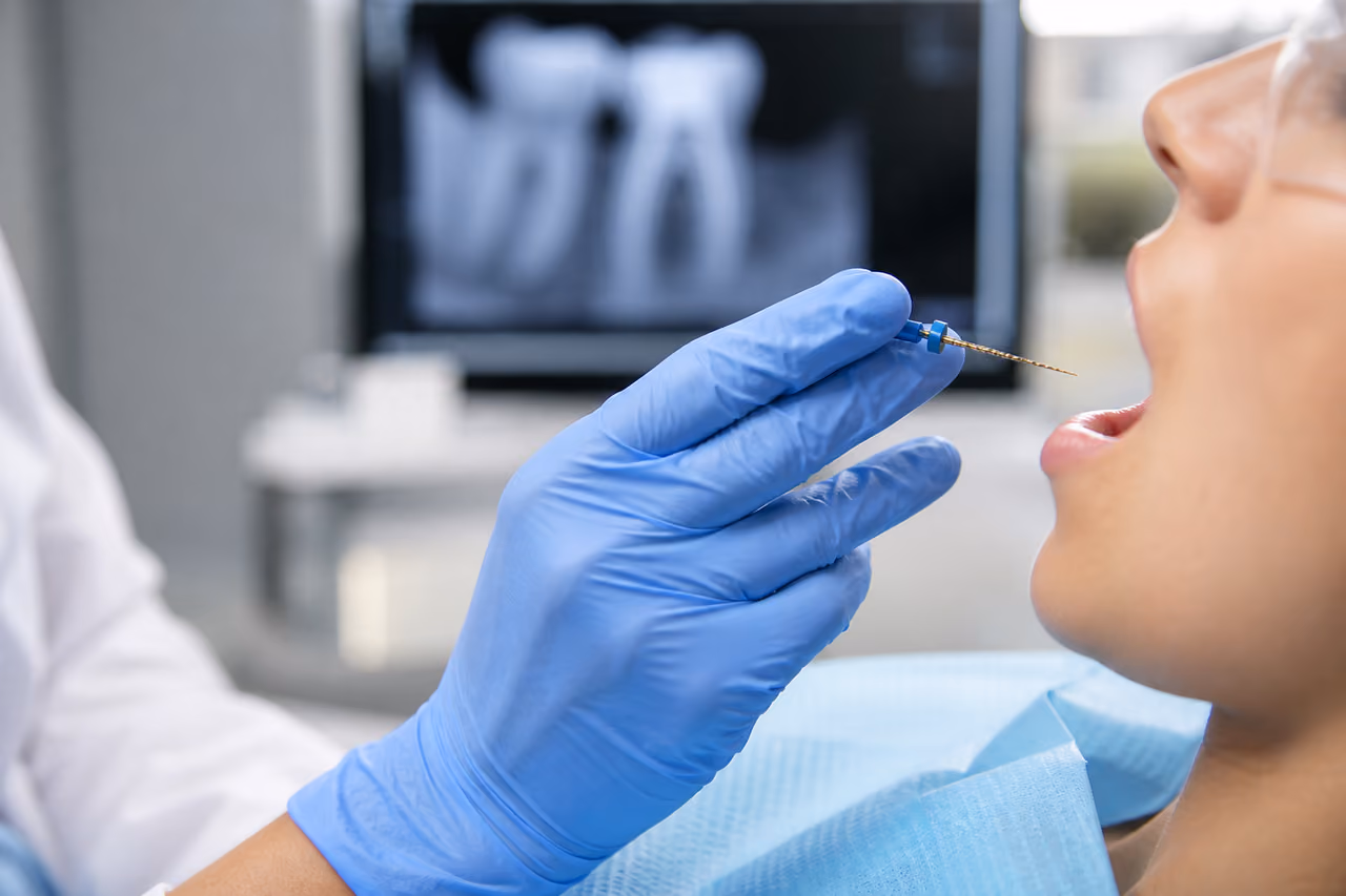 Endodontist Performing a Root Canal Treatment in a Dental Clinic