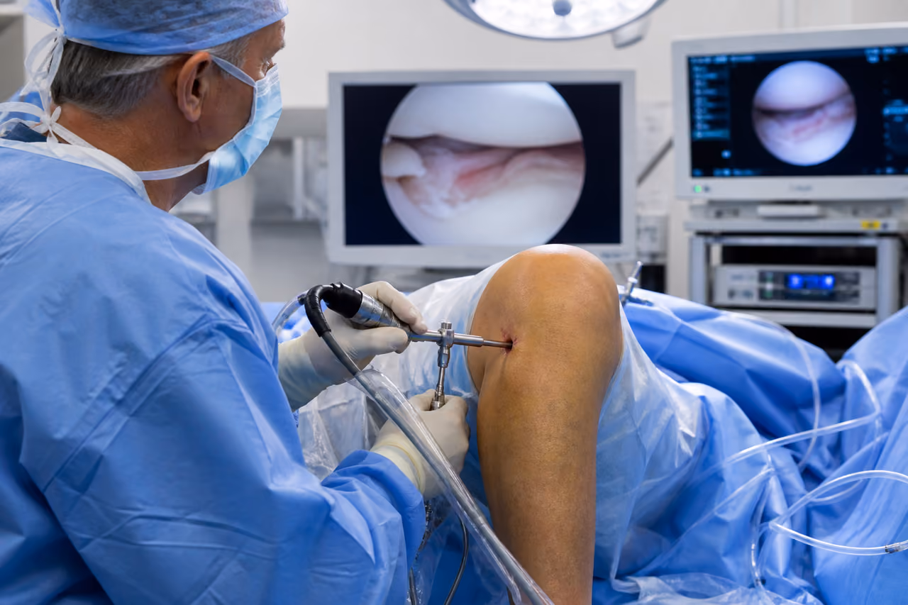 Orthopedic Surgeon Using Arthroscope for Meniscus Tear Examination